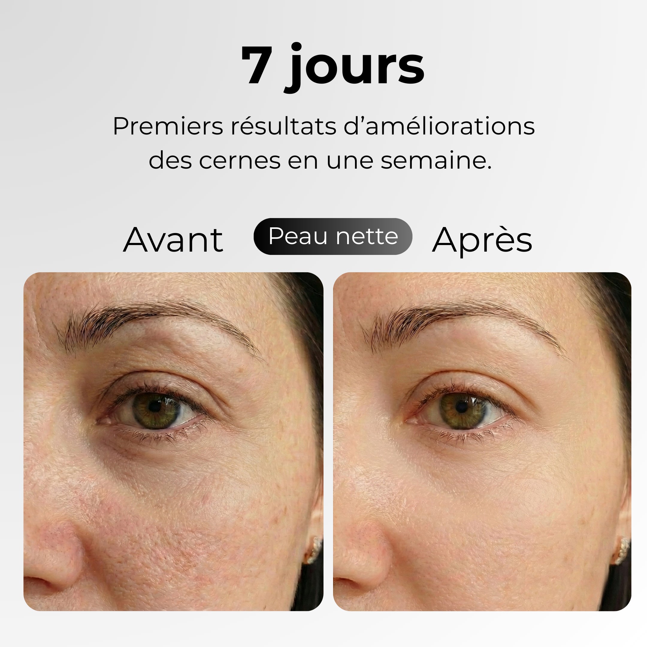 FreshGlam | Patchs contour des yeux