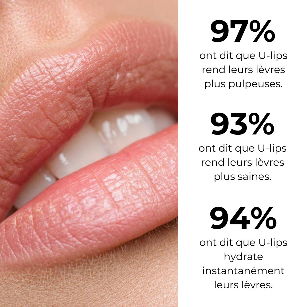 U-lips I Lip Plumper