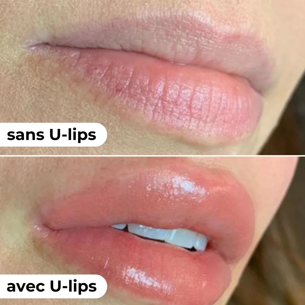 U-lips I Lip Plumper